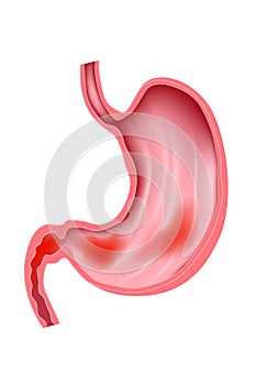 gastroduodenitis. photo